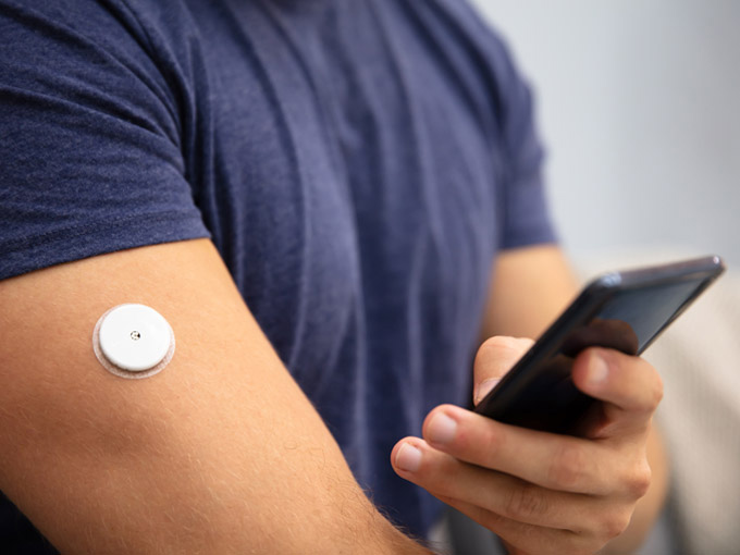 Ein kleiner runder Sensor auf dem Oberarm ermöglicht es, Blutzucker mit dem Handy zu messen.