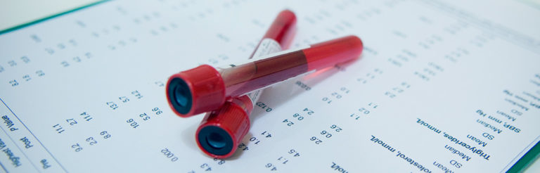 Zucker Im Urin Trotz Negativem Zuckertest Zucker im Urin: Häufige Ursachen und Testinfos Diabetes.Help