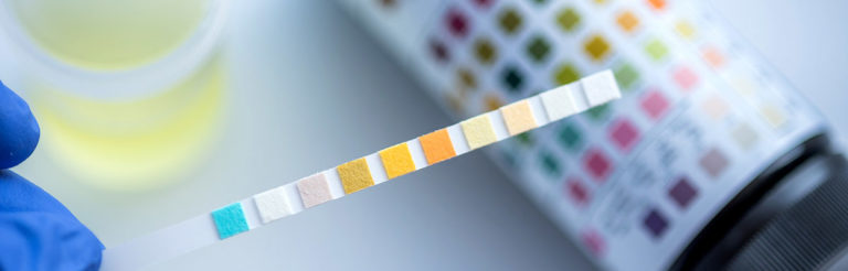 Zucker im Urin: Häufige Ursachen und Testinfos Diabetes.Help