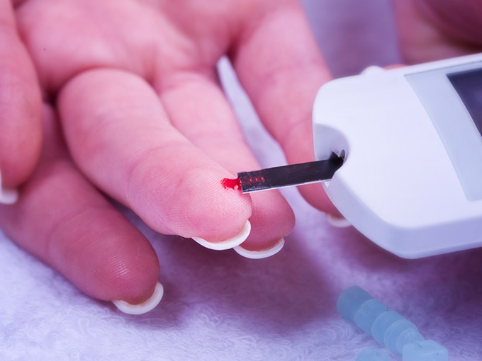 Blutstropfen am Finger wird zur HbA1c-Messung auf einen Teststreifen gegeben.