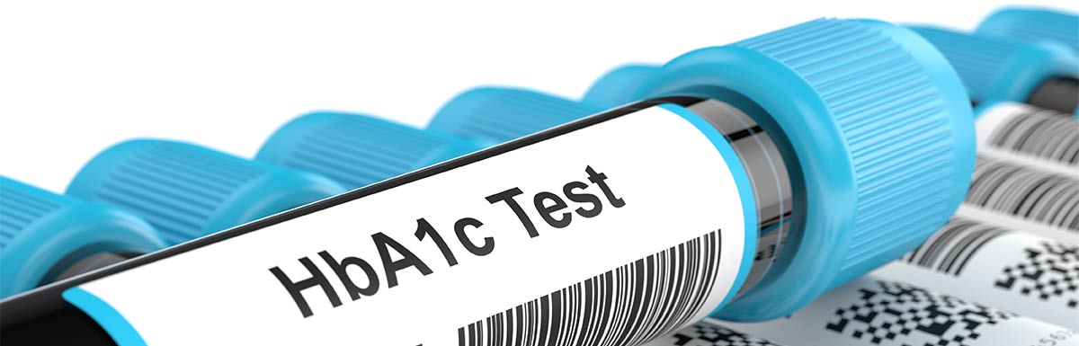 Ist der HbA1c zu niedrig? Ein Bluttest gibt Aufschluss.