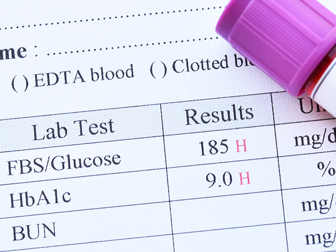 Ein HbA1c-Wert von neun Prozent ist zu hoch: Auf einem Tabellenblatt mit Laborergebnissen ist in der obersten Ecke ausschnitthaft der lila Deckel einer Blutprobe zu erkennen.